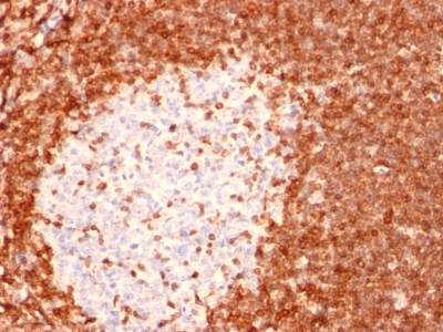 BCL-2 IHC Antibody 8C8