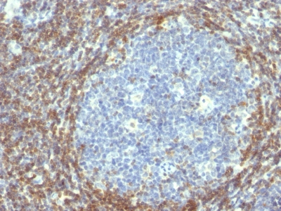 BCL-2 IHC Antibody Clone 782