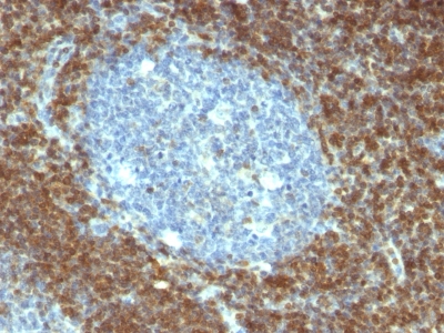 BCL-2 IHC Antibody