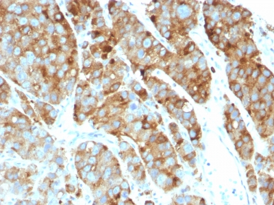 CD63 Antibody Clone LAMP3/968