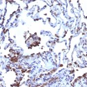 CD63 Antibody Clone NKI/C3 LAMP3/968