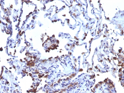 CD63 Antibody Clone NKI/C3 LAMP3/968