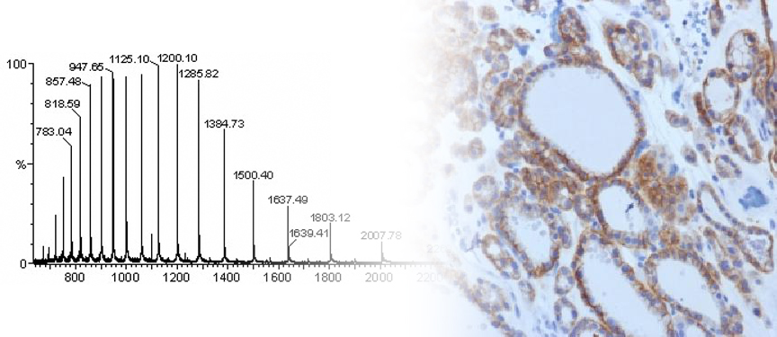 Mass Spec IHC Image