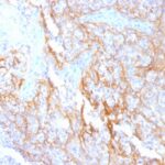 Formalin-fixed, paraffin-embedded human Tonsil stained with Beta-Catenin (p12) Monoclonal Antibody (15B8).