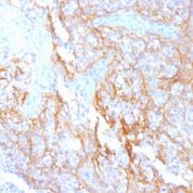 Formalin-fixed, paraffin-embedded human Tonsil stained with Beta-Catenin (p12) Monoclonal Antibody (15B8).