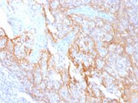 Formalin-fixed, paraffin-embedded human Tonsil stained with Beta-Catenin (p12) Monoclonal Antibody (15B8).