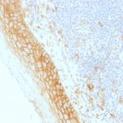 Formalin-fixed, paraffin-embedded human Tonsil stained with Beta-Catenin (p12) Monoclonal Antibody (CTNNB1/159).
