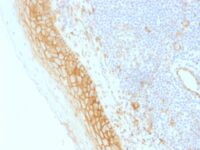 Formalin-fixed, paraffin-embedded human Tonsil stained with Beta-Catenin (p12) Monoclonal Antibody (CTNNB1/159).