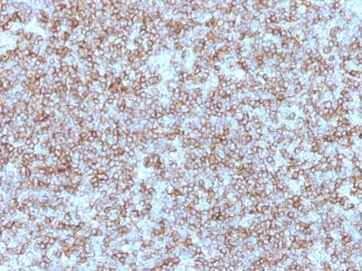 Formalin-fixed, paraffin-embedded human Tonsil stained with HLA-DP/DR Monoclonal Antibody (Bra-14).