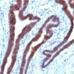 Staining by anti-Ep-CAM / CD326 Antibody 1