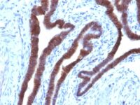 Staining by anti-Ep-CAM / CD326 Antibody 1