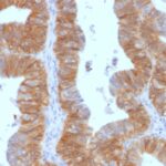 Staining by anti-Ep-CAM / CD326 Antibody 1