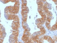 Staining by anti-Ep-CAM / CD326 Antibody 1