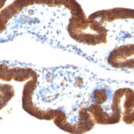 Staining by anti-Ep-CAM / CD326 Antibody 1