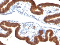 Staining by anti-Ep-CAM / CD326 Antibody 1