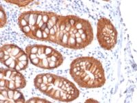 Staining by anti-Ep-CAM / CD326 Antibody 1