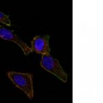 Staining by anti-Ep-CAM / CD326 Antibody 1