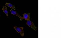 Staining by anti-Ep-CAM / CD326 Antibody 1