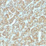 Staining by anti-Ep-CAM / CD326 Antibody 1