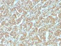 Staining by anti-Ep-CAM / CD326 Antibody 1