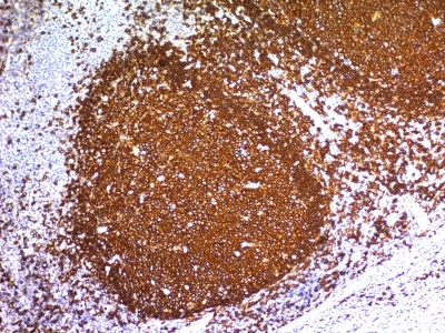 Formalin-fixed, paraffin-embedded human Tonsil stained with CD2 Monoclonal Antibody (L26)