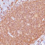 Formalin-fixed, paraffin-embedded human Tonsil stained with CD2 Monoclonal Antibody (L26 + IGEL/773)