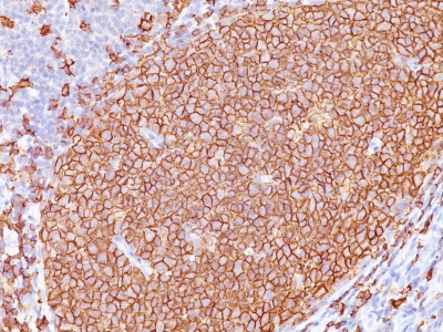 Formalin-fixed, paraffin-embedded human Tonsil stained with CD2 Monoclonal Antibody (L26 + IGEL/773)