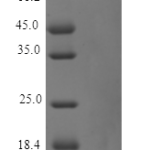 QP10148 Parathyroid Hormone