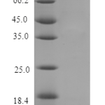 QP10149 Parathyroid Hormone