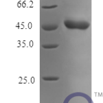 QP10161 SerpinB2 / PAI-2