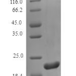 QP10162 TIMP2 / TIMP-2