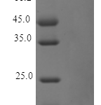 QP10182 Thymosin beta-4