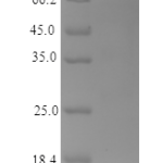 QP10197 L-FABP / FABP1