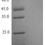 QP10207 CXCL3 / GRO gamma