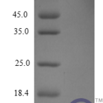 QP10209 CXCL5 / ENA-78