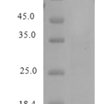 QP10212 NAP-2 / PPBP / CXCL7