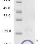 QP10238 CCL23 / MIP 3