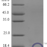 QP10242 CCL27 / CTACK