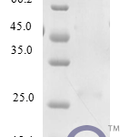 QP10244 FAM19A2