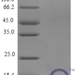 QP10247 Amyloid protein A