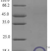 QP10247 Amyloid protein A