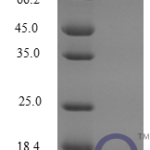 QP10261 CXCL16 / SR-PSOX