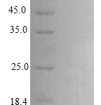 QP10272 CCL17 / TARC / SCYA17