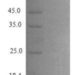 QP10274 CCL20 / MIP-3 alpha