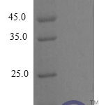 QP10276 CCL22 / MDC