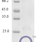 QP10278 C-C motif chemokine 25