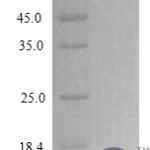 QP10281 CXCL2 / MIP-2