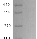 QP10283 CXCL3 / GRO gamma