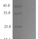 QP10285 NAP-2 / PPBP / CXCL7