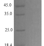 QP10287 CXCL12 / SDF-1 Isoform 1